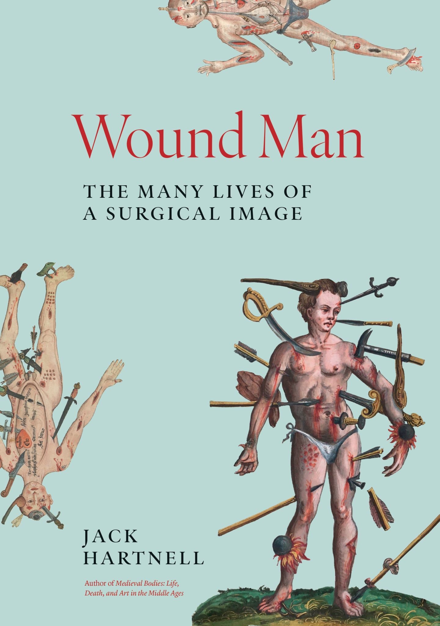 Wound Man Cover Image