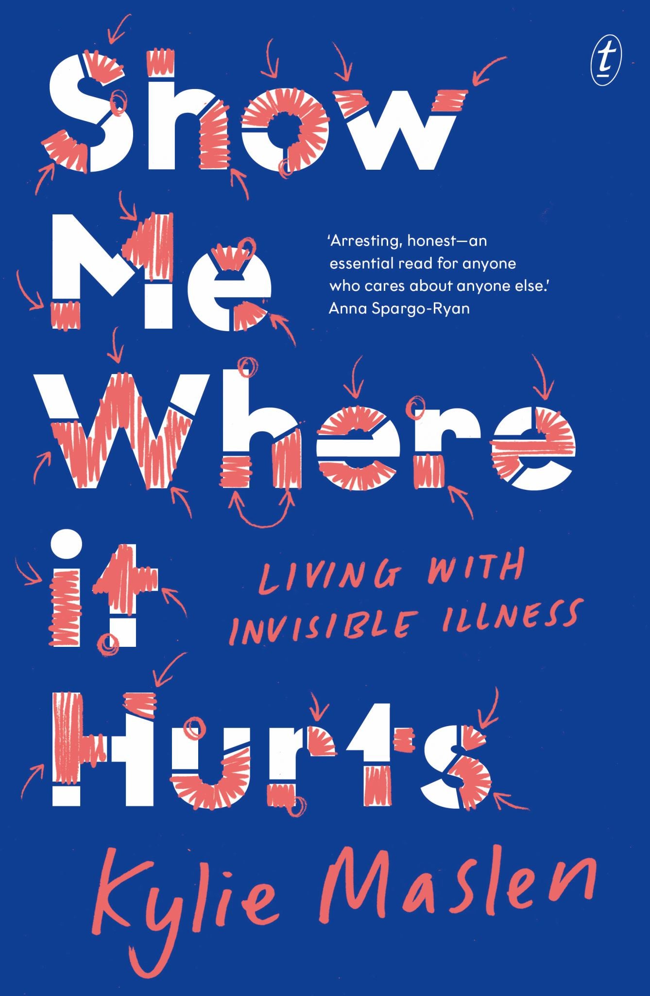 Show Me Where It Hurts Cover Image